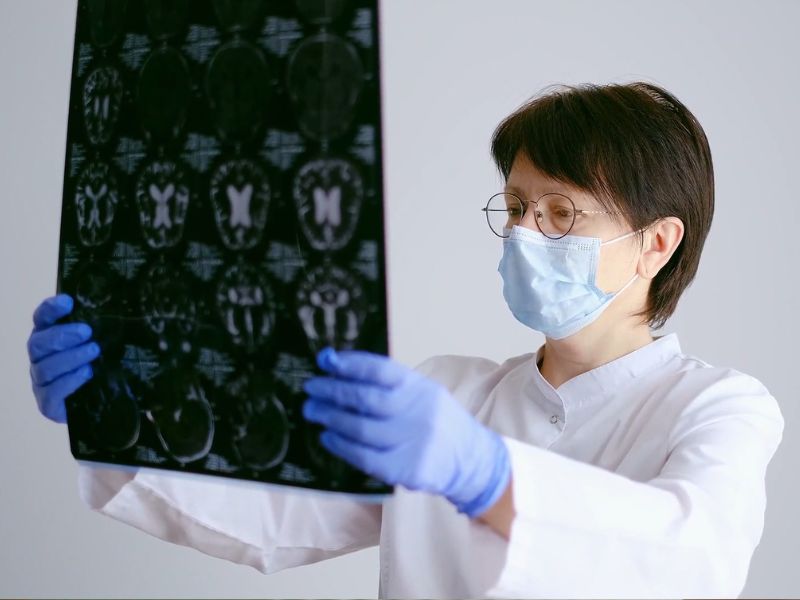 Šta se leči na neurologiji? Pregled najčešćih neuroloških poremećaja i bolesti